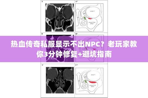 热血传奇私服显示不出NPC？老玩家教你3分钟修复+避坑指南